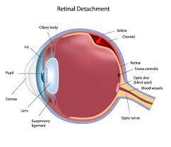CEN Retinal Detachment Review