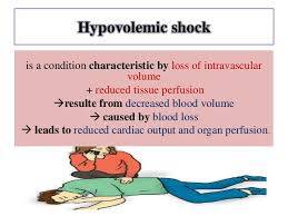 pccn hypovolemic shock