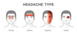 CEN Migraine Headache